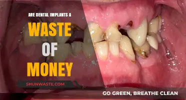 Are Dental Implants Worth It? Debunking the Money Myth