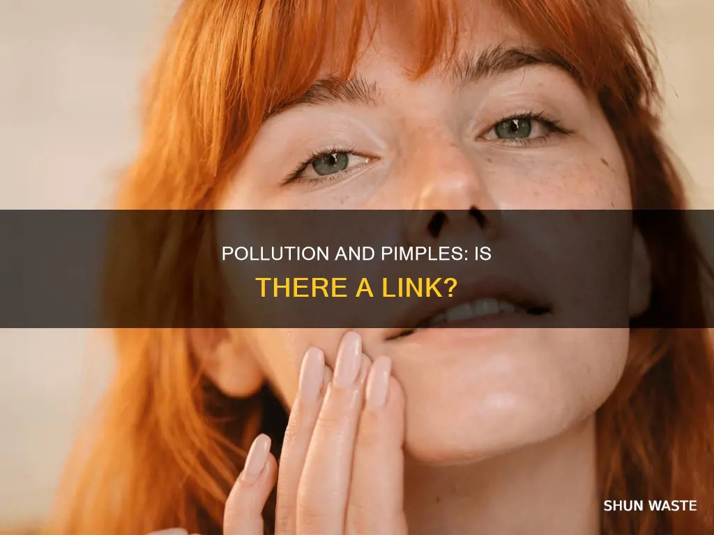 are my pimples on cheeks due to pollution