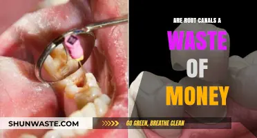 Root Canals: Worth the Investment or a Waste of Money?