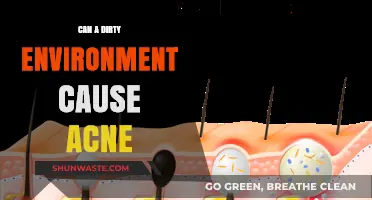 Dirty Surroundings and Skin Health: Can Environment Trigger Acne?
