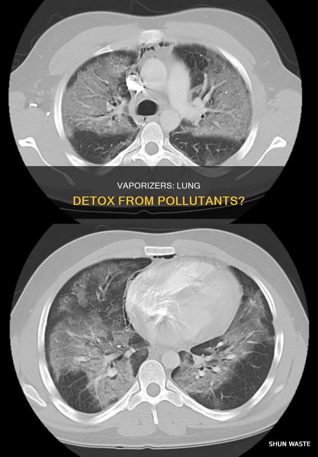can a vaporizer help with clearing pollutants from lungs