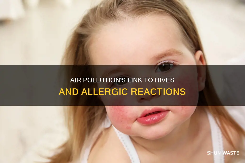 can air pollution cause hives