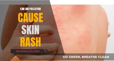 Air Pollution's Skin Rash: Is It Possible?