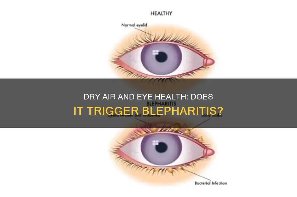 can an overly dry environment cause blepharitis