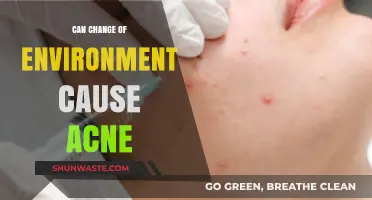 Does Your Environment Trigger Acne? Exploring the Surprising Connection