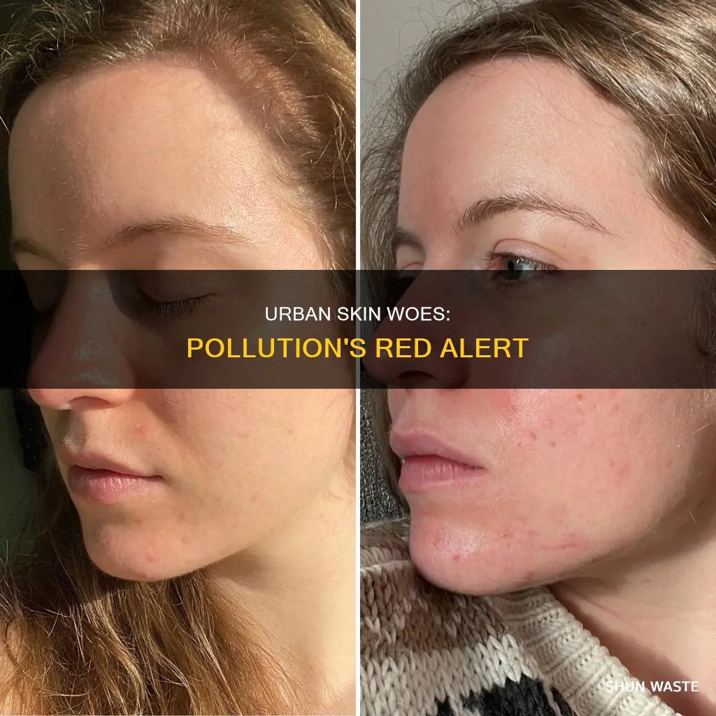 can city pollution make your skin red