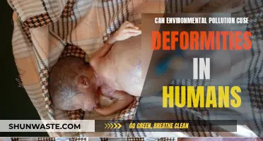 Pollution's Impact: Human Deformities and Environmental Toxins