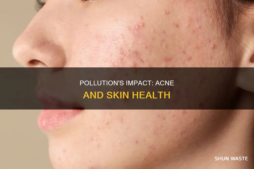 can pollution affect acne