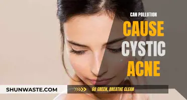 Pollution's Impact: Cystic Acne and Its Environmental Triggers