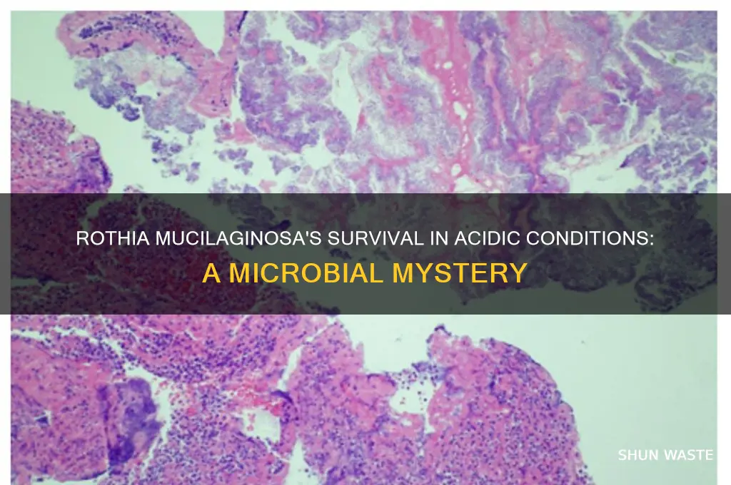 can rothia mucilaginosa grow in an acid environment