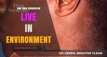Can Tinea Versicolor Survive Outside the Body? Environmental Insights