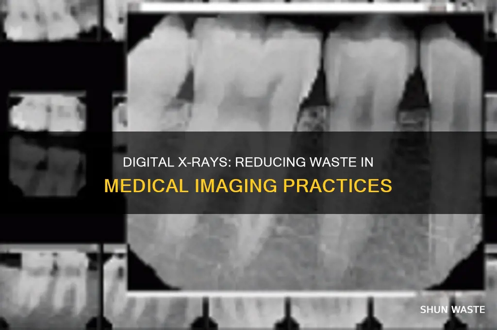 do digital x rays produce less waste