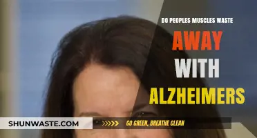 Alzheimer's Impact: Does Muscle Atrophy Accompany Cognitive Decline?