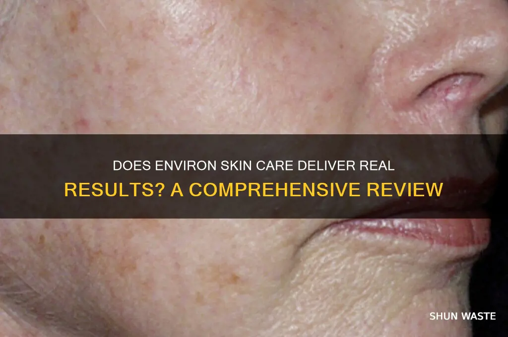 does environ skin care really work