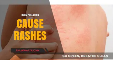 Unveiling the Skin's Reaction: Pollution's Impact on Rashes