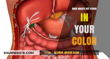 Does Waste Get Stuck in Your Colon? Unraveling the Truth