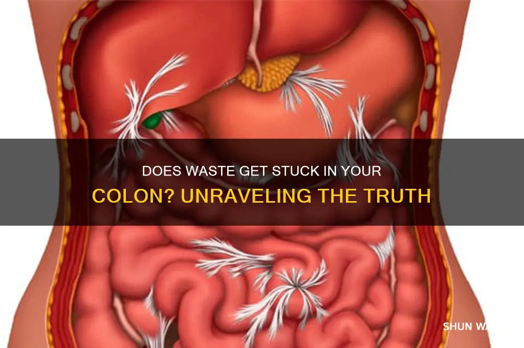 does waste get stuck in your colon