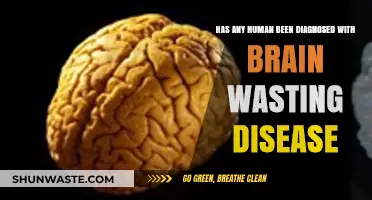 Brain Wasting Disease: Has Any Human Ever Been Diagnosed?