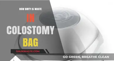 Understanding Colostomy Bag Waste: Debunking Myths About Cleanliness and Hygiene