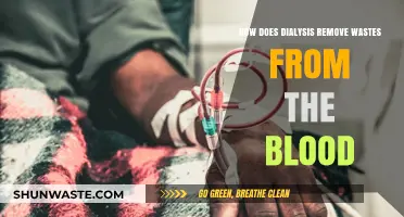 Dialysis Explained: How It Effectively Removes Wastes from Blood