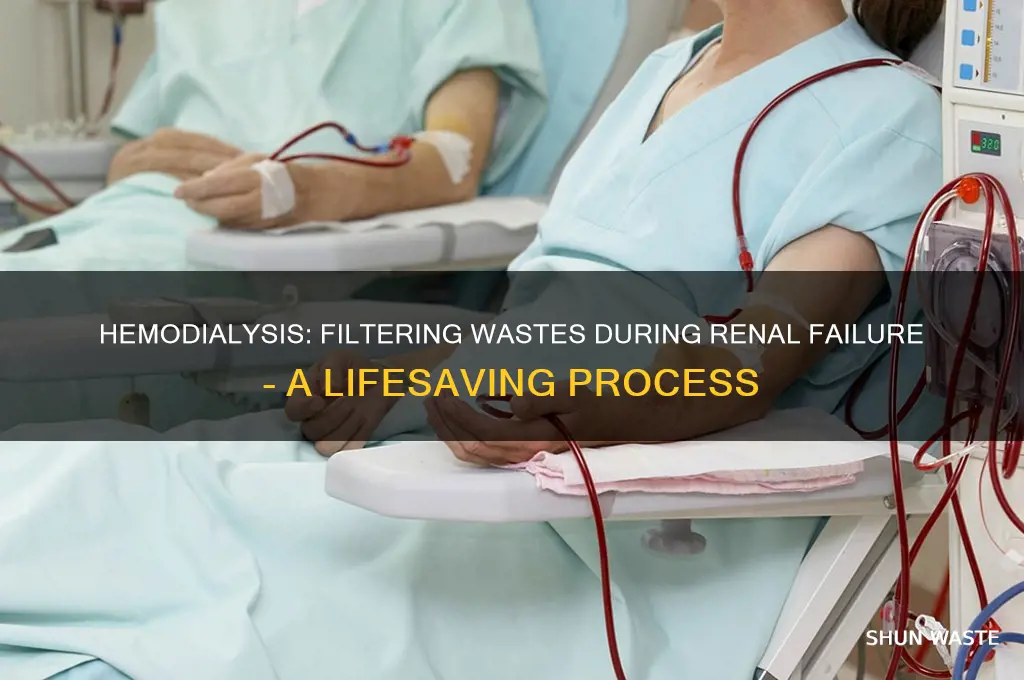 how does hemodialysis filter out wastes during renal failure