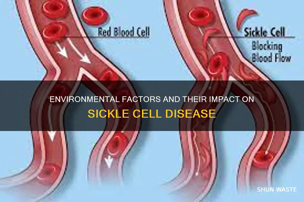 how does the environment affect sickle cell disease