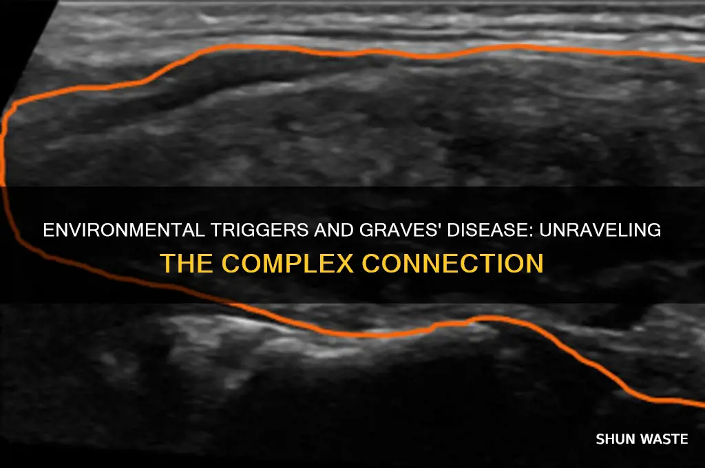 how environment affects graves disease