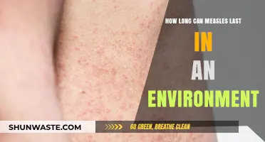 Measles Survival: How Long Does the Virus Linger in Environments?