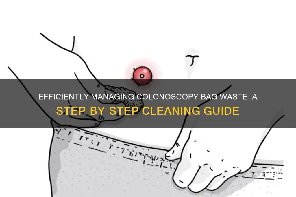 how to clean up colonoscopy bag waste
