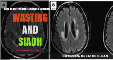 Cerebral Salt Wasting vs. SIADH: Key Differences and Diagnostic Tips