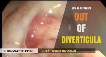 Effective Strategies to Eliminate Waste from Diverticula Naturally