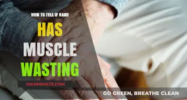 Identifying Hand Muscle Wasting: Key Signs and Symptoms to Watch For