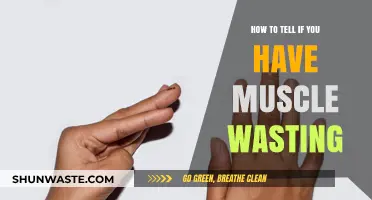 Identifying Muscle Wasting: Key Signs and Symptoms to Watch For