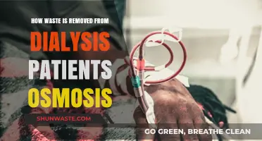 Osmosis in Dialysis: Efficient Waste Removal Explained Simply