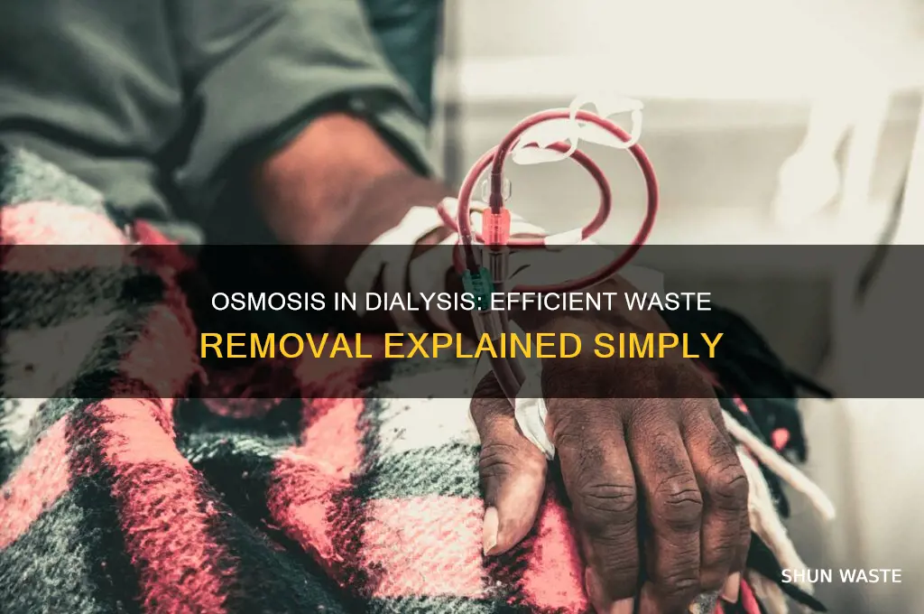 how waste is removed from dialysis patients osmosis
