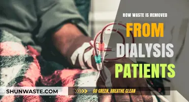 Efficient Dialysis Waste Removal: Understanding the Process for Patients