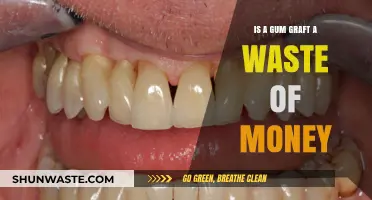 Gum Grafts: Worth the Investment or Unnecessary Expense?