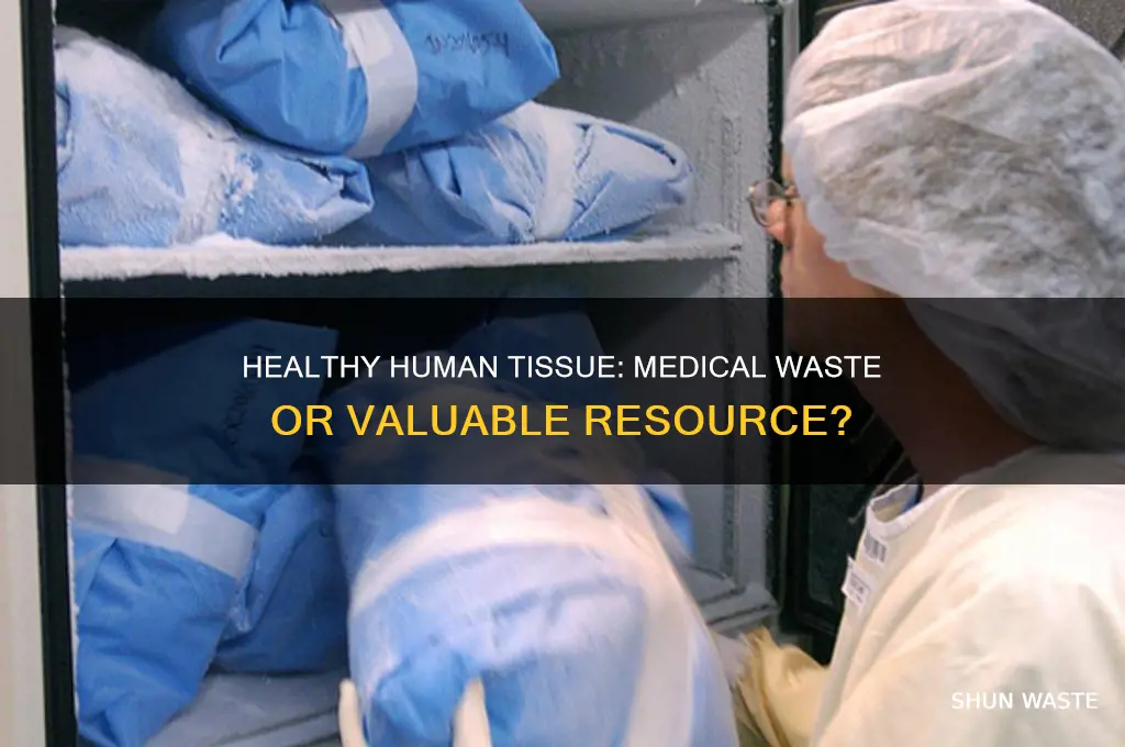 is discarded tissue from a healthy human medical waste