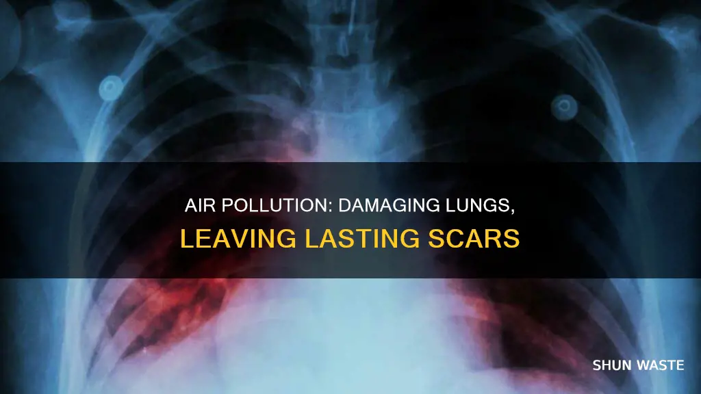 what air pollutant scars the lungs