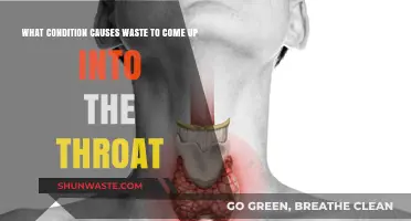 Understanding Acid Reflux: Why Waste Rises into the Throat