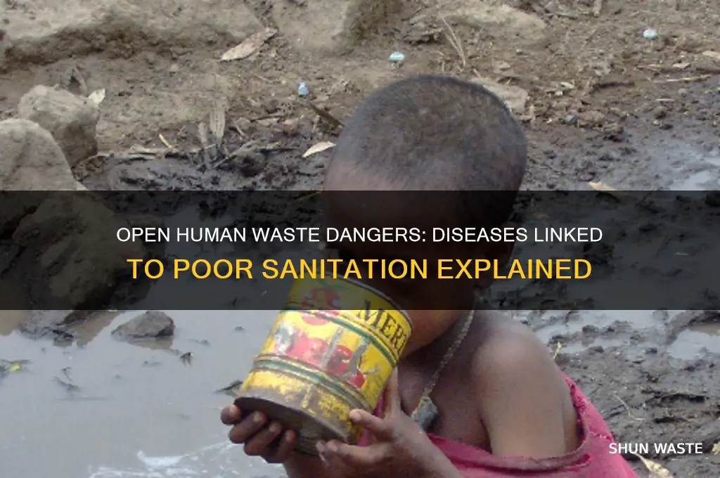 what disease is caused by open human waste
