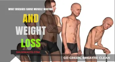 Muscle Wasting and Weight Loss: Diseases Behind These Symptoms