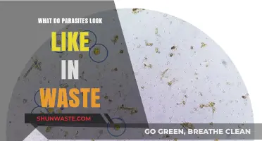 Unveiling Parasites: Visual Guide to Their Appearance in Human Waste