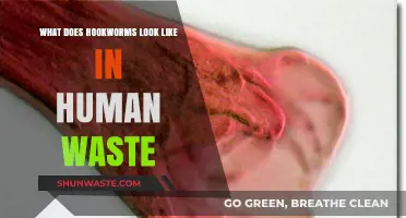 Unveiling the Appearance of Hookworms in Human Waste: A Visual Guide