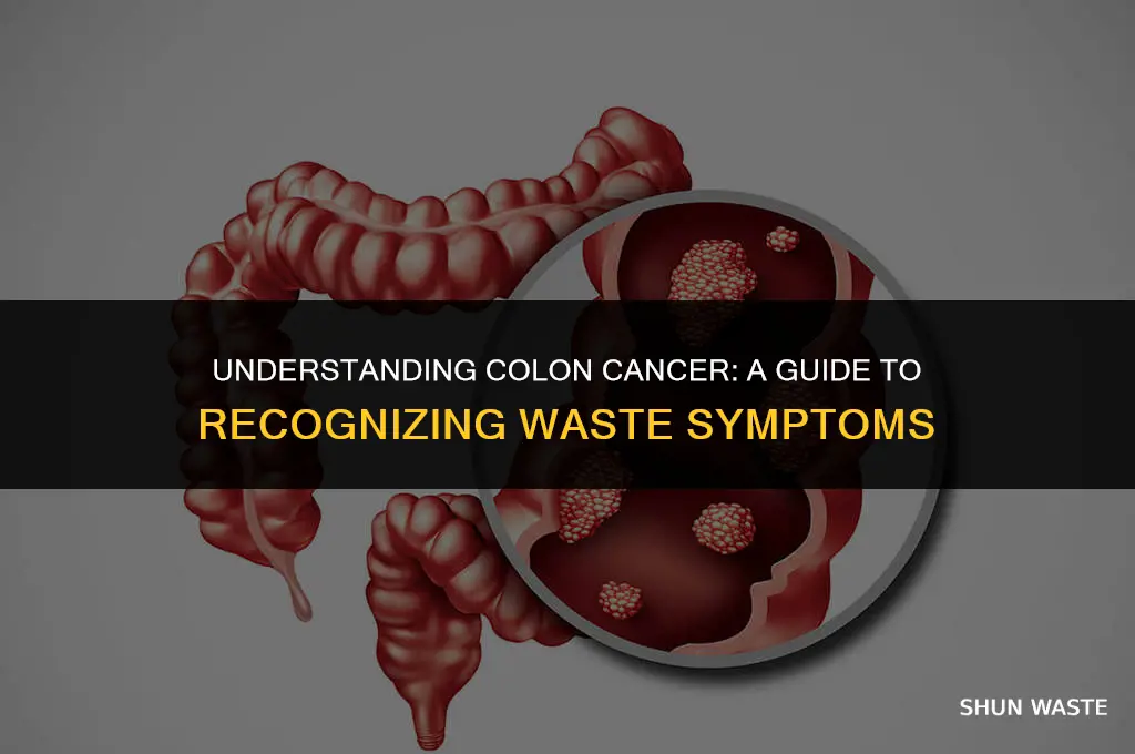 what does waste from colon cancer look like