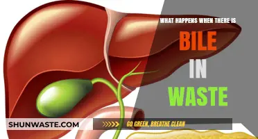 Bile in Waste: Causes, Symptoms, and Health Implications Explained