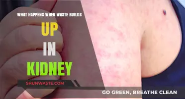 Kidney Waste Buildup: Causes, Symptoms, and Health Risks Explained