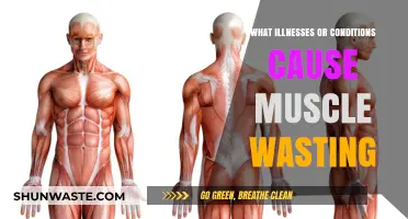 Understanding Muscle Wasting: Diseases and Conditions Behind This Symptom