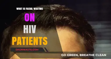 Understanding Facial Wasting in HIV Patients: Causes, Impact, and Management