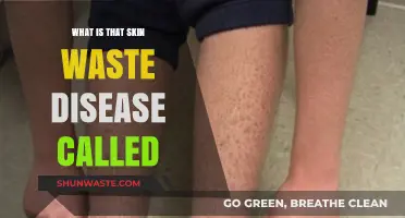 Understanding Ichthyosis: The Skin Condition Causing Excessive Waste Buildup
